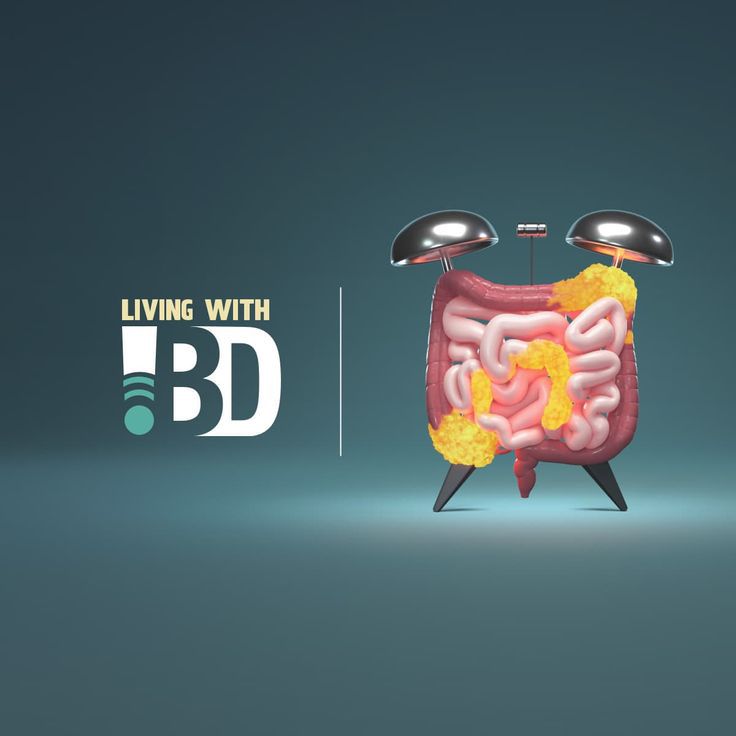 IBD Treatment - Crohn's & Colitis